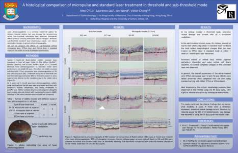 A histological comparison of micropulse and standard laser treatment in threshold and sub-threshold mode Amy CY 1. 1 Lo ,