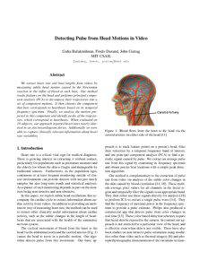 Detecting Pulse from Head Motions in Video Guha Balakrishnan, Fredo Durand, John Guttag MIT CSAIL