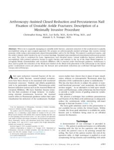 Arthroscopy-Assisted Closed Reduction and Percutaneous Nail Fixation of Unstable Ankle Fractures: Description of a Minimally Invasive Procedure