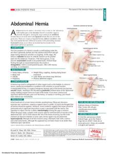Abdominal Hernia  SURGERY The Journal of the American Medical Association