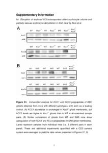 Supplementary Information for ‚Disruption of erythroid KCl-cotransporters alters erythrocyte volume and partially rescues erythrocyte dehydration in SAD mice’ by Rust et al. Figure S1. Immunoblot analysis for KCC1 an