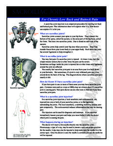 sacroiliac Joint Injection For Chronic Low Back and Buttock Pain A sacroiliac joint injection is an outpatient procedure for treating low back and buttock pain. This information sheet will explain what it is. Your doctor