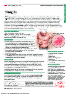 The Journal of the American Medical Association  Shingles S