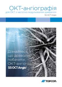 ОКТ-ангіографія    для ОКТ з частотно-модульованим джерелом SS OCT Angio  Дізнайтеся,