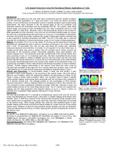 A 21 channel Transceiver Array for Non-human Primate Applications at 7 tesla. 1 G. Adriany1, N. Harel1, E. Yacoub1, S. Moeller1, G. Ghose1, and K. Ugurbil1 Center for Magnetic Resonance Research, University of Minnesota 