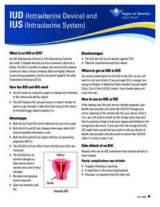 IUD (Intrauterine Device) and IUS (Intrauterine System) What is an IUD or IUS? Disadvantages