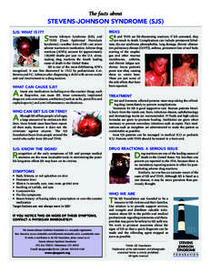 The facts about  STEVENS-JOHNSON SYNDROME (SJS) RISKS  SJS: WHAT IS IT?