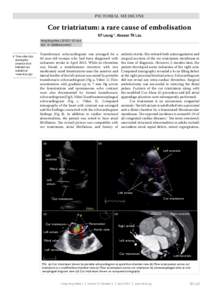 PICTORIAL MEDICINE  Cor triatriatum: a rare cause of embolisation KF Leung *, Alexson TK Lau  Hong Kong Med J 2015;21:187.e3-4