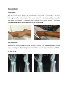 Osteochondroma Patient Profile: Mrs. Vinisha Verma (name changed), 42 year old female presented with painless swelling in the region of the right wrist. There was a history of blunt trauma to the right wrist joint about 