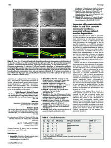 1720  PostScript telangiectasis in three-dimensional optical coherence tomography. Am J Ophthalmol 2006;142:340–3. 9 Gaudric A, Ducos de Lahitte G, Cohen SY, et al.