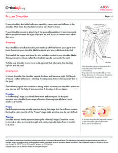 .org Frozen Shoulder Page[removed]Frozen shoulder, also called adhesive capsulitis, causes pain and stiffness in the