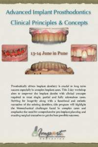 Advanced Implant Prosthodontics Clinical Principles & ConceptsJune in Pune  Prosthetically driven implant dentistry is crucial to long term