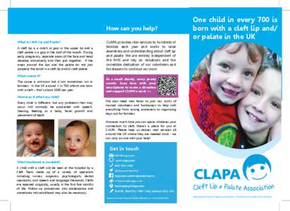 Cleft lip and palate / Members of the Order of the British Empire / Congenital disorders / Carol Vorderman / Cleft / Speech and language pathology / European Cleft Organisation / Cleft lip and palate organisations / Medicine / Health / Cleft Lip and Palate Association
