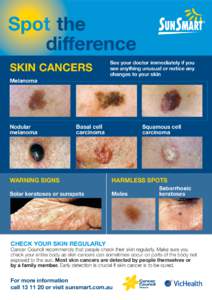 Spot the difference SKIN CANCERS Melanoma  Nodular