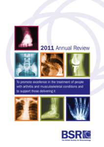 2011 Annual Review  To promote excellence in the treatment of people with arthritis and musculoskeletal conditions and to support those delivering it
