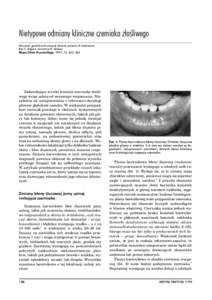 Nietypowe odmiany kliniczne czerniaka złos´liwego Mucosal, genital and unusual clinical variants of melanoma Roy S. Rogers, Lawrence E. Gibson