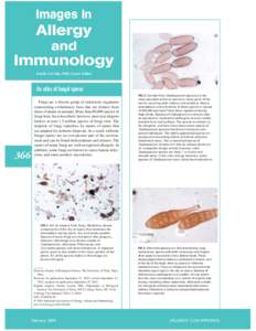 Allergology / Cladosporium herbarum / Alternaria / Mycology / Cladosporium / Spore / Conidium / Allergen / Basidiospore / Biology / Ascomycota / Capnodiales