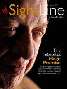 Sight SightLine Spring 2013 Wilmer Eye Institute at Johns Hopkins