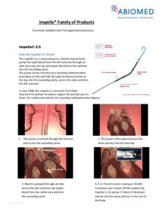 Impella® Family of Products (Currently available with FDA approvals/clearances) Impella® 2.5 How the Impella 2.5 Works The Impella 2.5 is a percutaneous, catheter-based heart