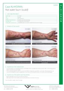 AL20-001  Case ALHYDRAN: Hot water burn (scald) 1.	 Case study description patient age