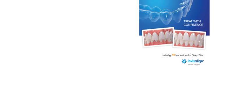 TREAT WITH CONFIDENCE SmartForce Clinical Innovations ® FOR MORE INFORMATION, visit learn.invisalign.com/G5