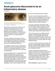 Acute glaucoma discovered to be an inflammatory disease