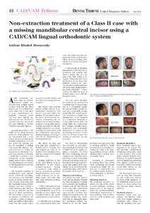 16 CAD/CAM Tribune  United Kingdom Edition July 2014