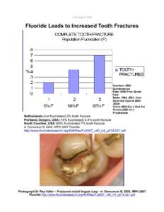 CAClinch © 2010  Fluoride Leads to Increased Tooth Fractures Guertsen 2003 Quintessence