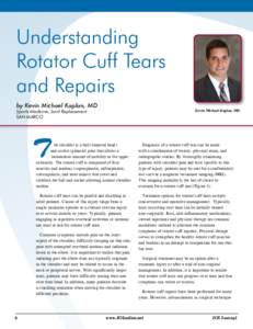 Understanding Rotator Cuff Tears and Repairs by Kevin Michael Kaplan, MD Sports Medicine, Joint Replacement San Marco