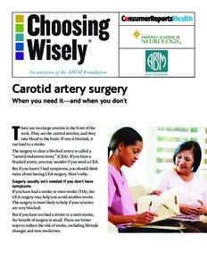 ®  Carotid artery surgery When you need it—and when you don’t  T