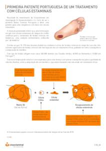 PRIMEIRA PATENTE PORTUGUESA DE UM TRATAMENTO COM CÉLULAS ESTAMINAIS Resultado do investimento da Crioestaminal em Investigação & Desenvolvimento, é o facto de ser o primeiro Banco Familiar Português a deter uma pate
