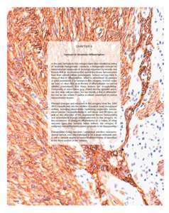 Myxoma / Angiomyxoma / Ewing sarcoma / International Classification of Diseases for Oncology / Histiocytoma / Pleomorphic undifferentiated sarcoma / CD34 / Cutaneous myxoma / Thymus / Medicine / Oncology / Sarcoma