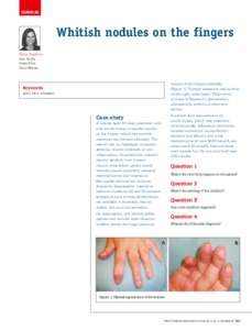CLINICAL  Whitish nodules on the fingers Eliana Bonifácio Ana Rocha Joana Silva
