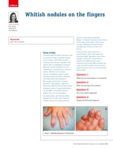 Anatomy / Rheumatology / Inborn errors of purine-pyrimidine metabolism / Uric acid / Non-steroidal anti-inflammatory drugs / Tophus / Gout / Hyperuricemia / Acute uric acid nephropathy / Medicine / Health / Arthritis