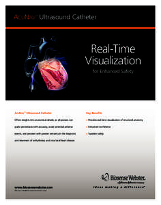 AcuNav Ultrasound Catheter ™ Real-Time Visualization for Enhanced Safety