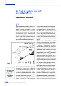 Le lenti a contatto morbide per astigmatismo Roberto Pregliasco, Silvio Maffioletti L’