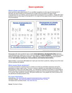 Microsoft Word - Down syndrome.doc