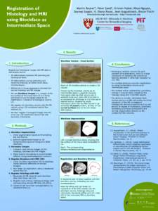 Registration of Histology and MRI using Blockface as Intermediate Space  Martin Reuter*, Peter Sand*, Kristen Huber, Khoa Nguyen,