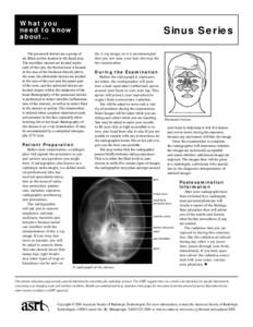 What you need to know about… The paranasal sinuses are a group of air-filled cavities located in the facial area. The maxillary sinuses are located under