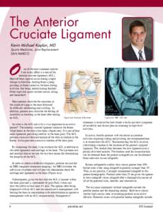 The Anterior Cruciate Ligament Kevin Michael Kaplan, MD Sports Medicine, Joint Replacement San Marco