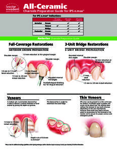 emax chairside prep guide