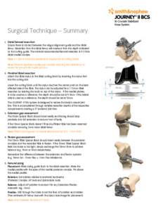 Surgical Technique – Summary 1. Distal femoral resection Ensure there is contact between the valgus alignment guide and the distal femur. Resection from the distal femur will measure from the depth indicated