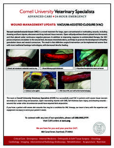 WOUND MANAGEMENT UPDATE: VACUUM-ASSISTED CLOSURE (VAC) Vacuum-assisted wound closure (VAC) is a novel treatment for large, open contaminated or nonhealing wounds, including shearing and burn injuries, abscesses and drug-