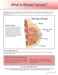 What is Breast Cancer? What is Breast Cancer? Breast cancer is cancer that forms in tissues of the breast, usually the ducts (tubes that carry milk to the nipple) and lobules (glands that make milk). It occurs in both me