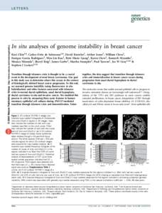 In situ analyses of genome instability in breast cancer Koei Chin1,6, Carlos Ortiz de Solorzano2,6, David Knowles2, Arthur Jones3, William Chou2, Enrique Garcia Rodriguez2, Wen-Lin Kuo1, Britt-Marie Ljung4, Karen Chew1, 