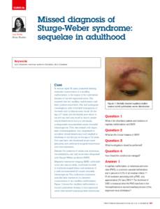 Sturge–Weber syndrome / Port-wine stain / Angiomatosis / Sturge / Glaucoma / Angioma / Hemangioma / Medicine / Health / Benign neoplasms