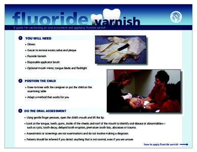 ﬂuoride  varnish A guide for conducting an oral assessment and applying ﬂuoride varnish