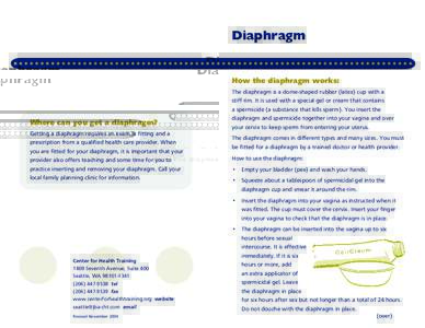 Diaphragm  How the diaphragm works: Where can you get a diaphragm? Getting a diaphragm requires an exam, a fitting and a