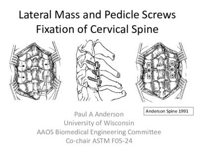 Lateral Mass and Pedicle Screws Fixation of Cervical Spine