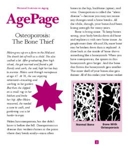 AgePage: Osteoporosis: The Bone Thief